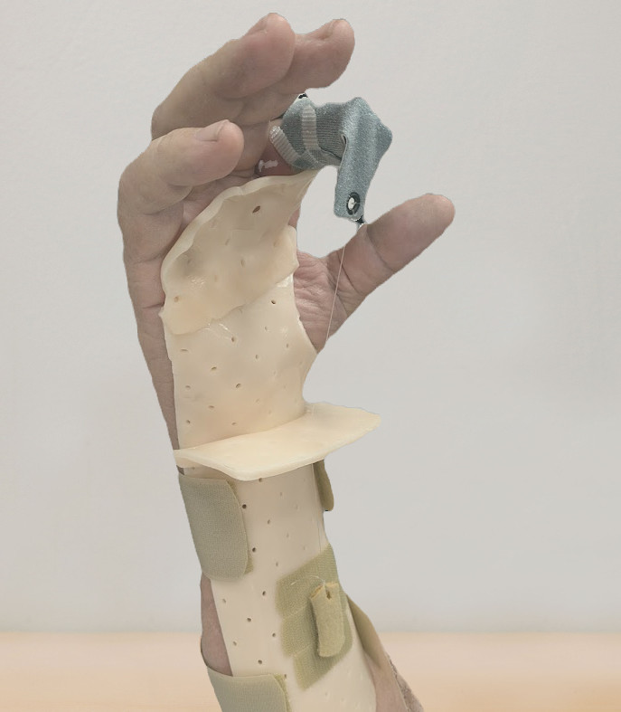splint