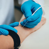 Patient nerves testing using electromyography. Medical examination. emg.jpg