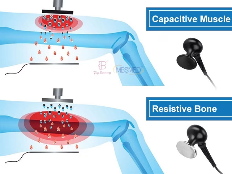 Cos'è la radiofrequenza