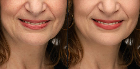 Headshot Retouching: How Much Is Too Much? Making Sure You Still Look Like Yourself