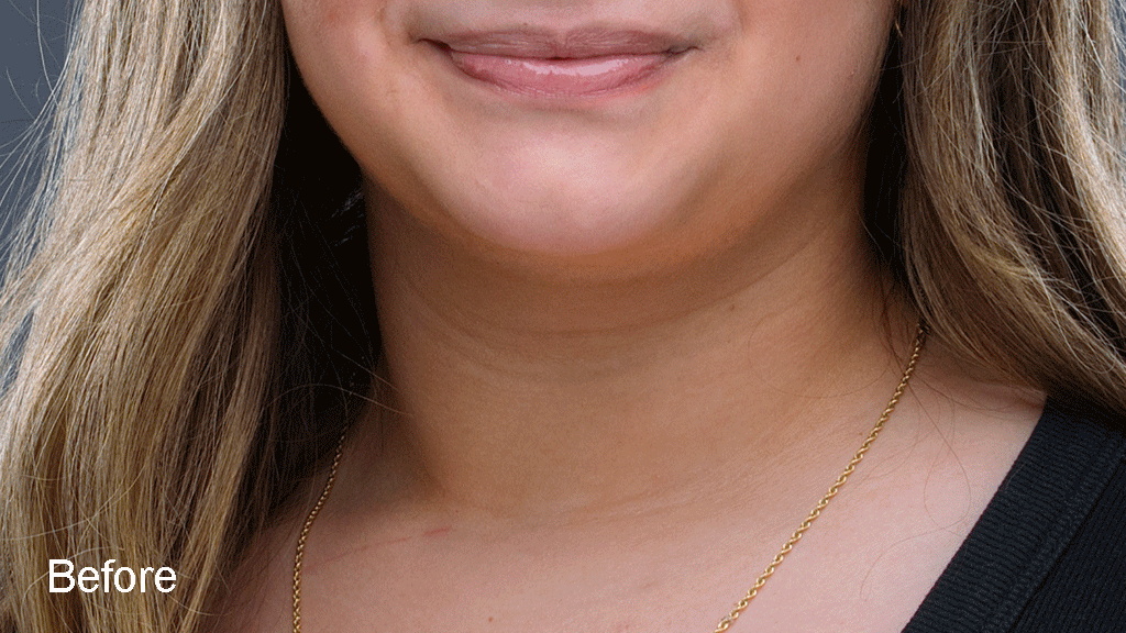 Retouching_before-and-after