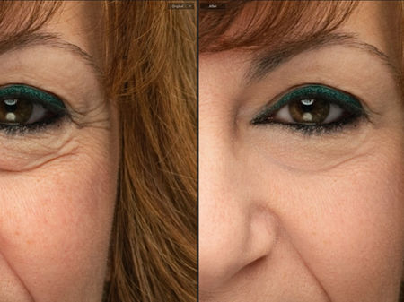 Before and after headshot retouching showing reduced wrinkles and smoother skin around eye