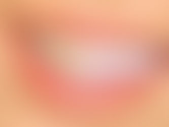 Por que os dentes amarelam com a idade?