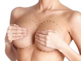 Você sabia que 3 em cada 10 mulheres já pensaram em colocar silicone nos seios?