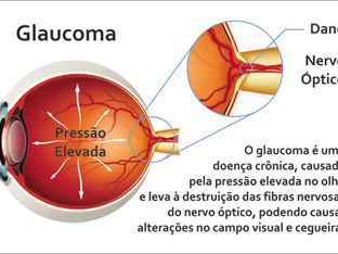 Dia nacional de combate contra o glaucoma