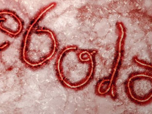 Ebola: doença mata até 90% das pessoas contaminadas