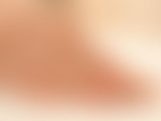 Saiba como evitar a contaminação por vírus na manicure