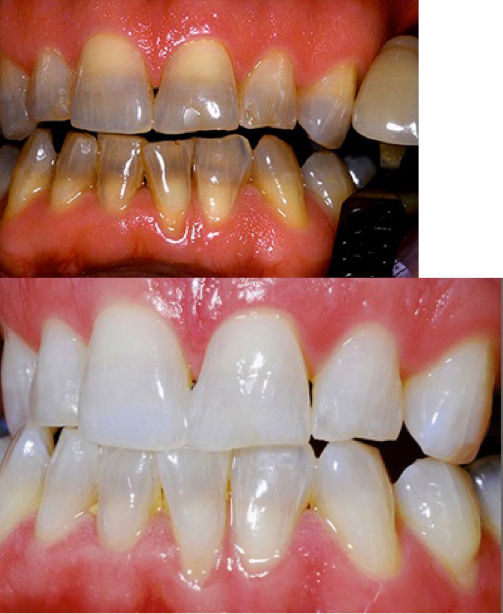 We use www.korwhitening.com