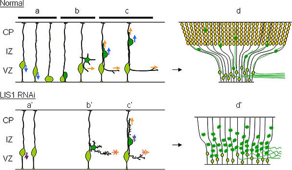 Neuronal migration
