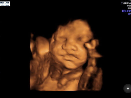 The last 11 weeks…