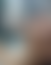 Understanding the Latest Innovations in Skin Care