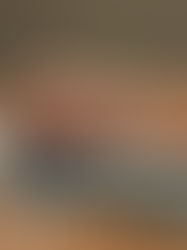 2025 Skin Rejuvenation Trends: Advanced Treatments for Radiant, Youthful Skin