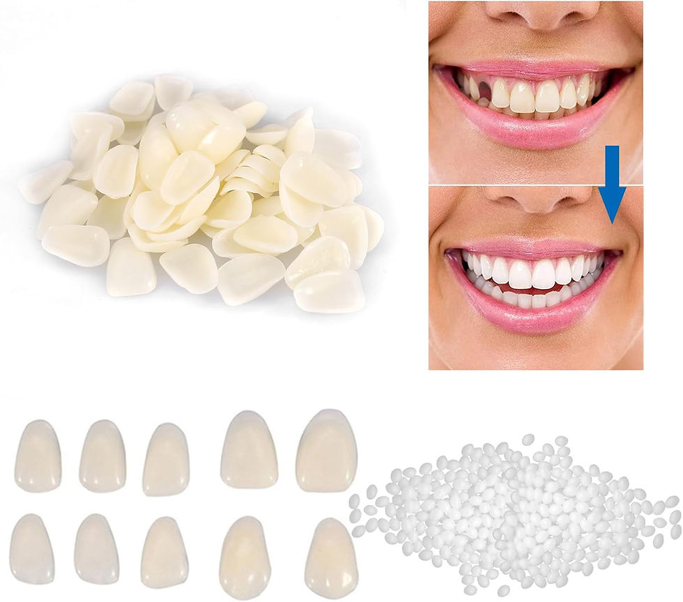 reçine kaplama diş