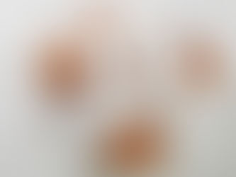 Cholesterol and Why Its Ok to Eat Your Eggs