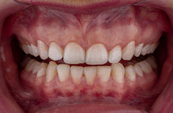 gessicafrontal