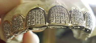 Thumbnail: Gold Grill