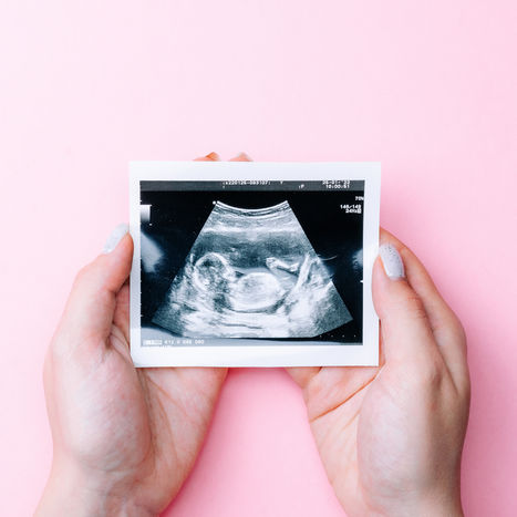 VANISHING TWIN SYNDROME: WOMAN STUNNED TO FIND NAILS, HAIR, TEETH IN LUMP