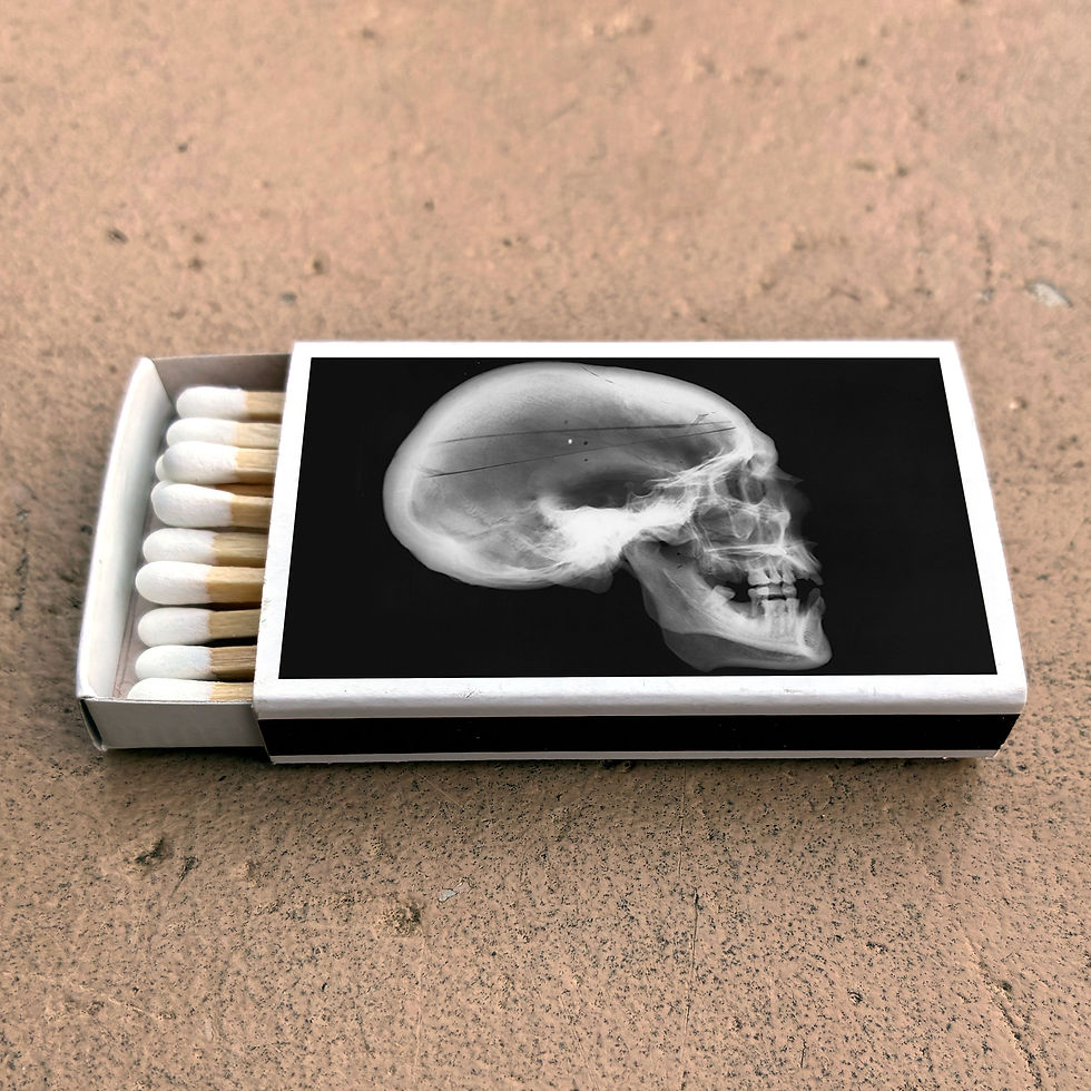 Thumbnail: Matches • Skull Xray Matchboxes • Home Decor for Candles • Custom Matches