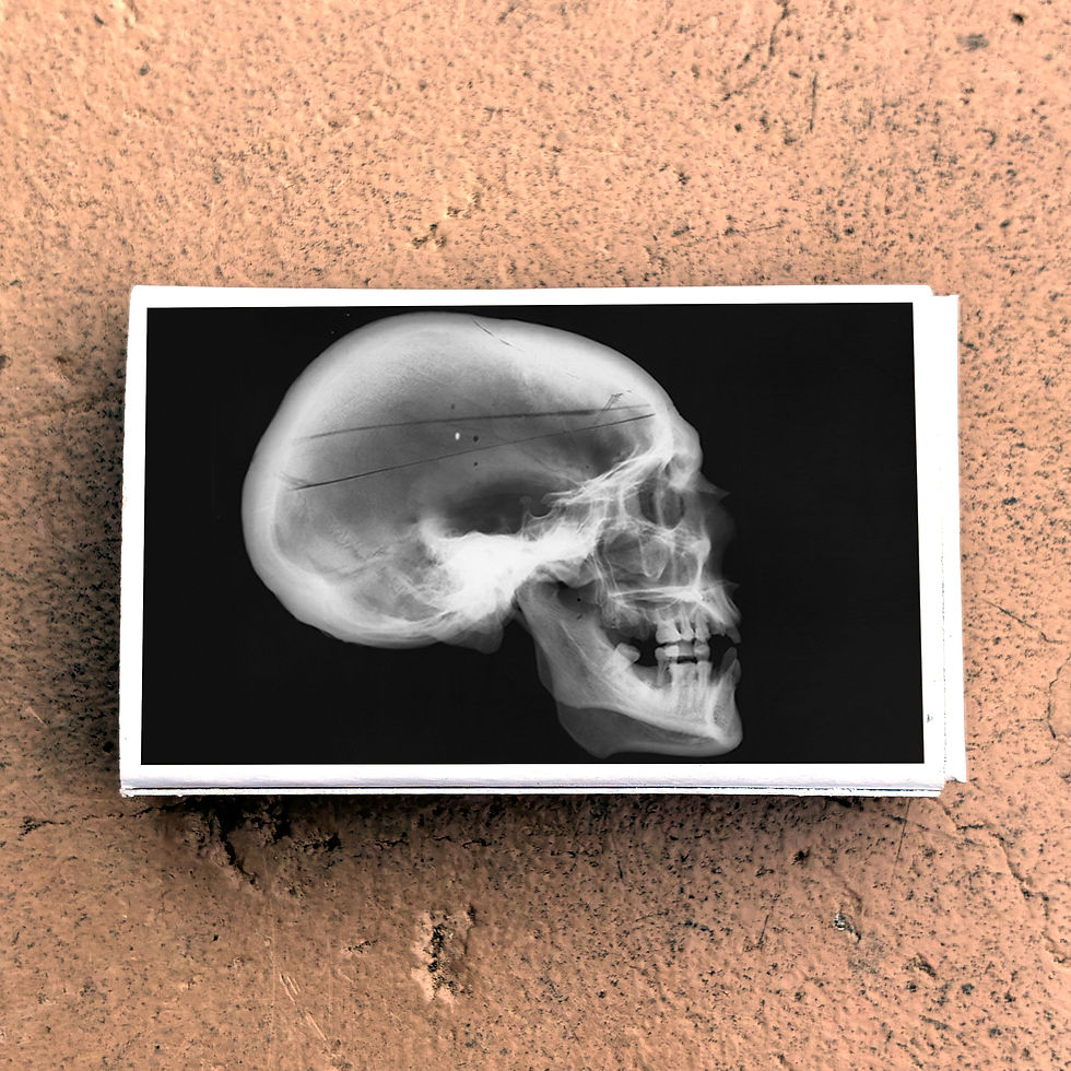 Thumbnail: Matches • Skull Xray Matchboxes • Home Decor for Candles • Custom Matches