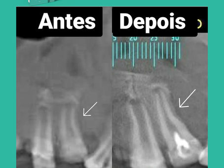 Caso Clínico - Dra. Angelita Freitas
