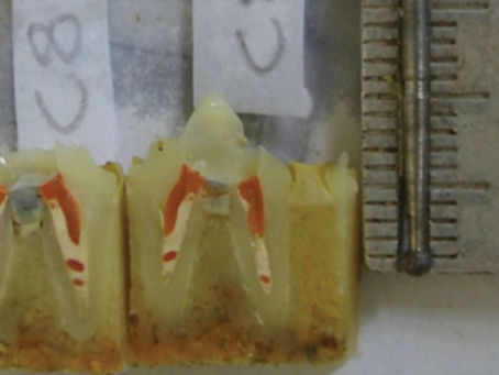 Cimento Portland com aditivos na reparação de perfurações radiculares em cães