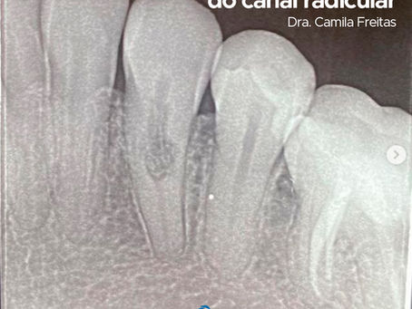 Caso Clínico - Dra. Camila Freitas