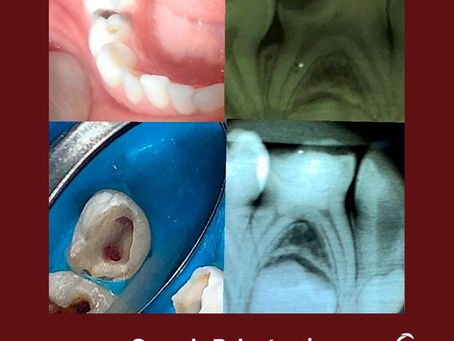 Caso clínico - Ana Carla Junqueira