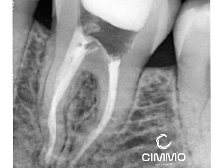 Caso clínico - Joênio Tolentino Jr