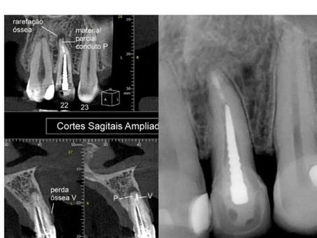 Caso Clínico - Prof. Danilo de Luca Campos