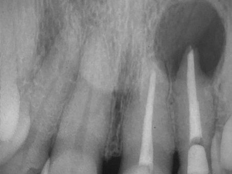 Caso Clínico - Dr. André Bessoni