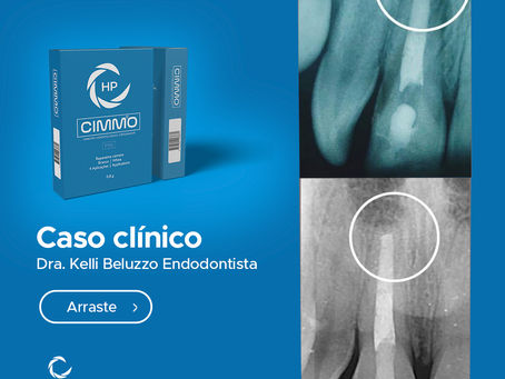 Caso Clínico - Dra. Kelli Beluzzo