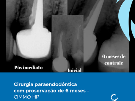 Caso clínico - Danilo Campos
