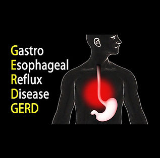 GERD heartburn atlanta gastro eseophageal reflux