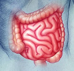 celiac disease