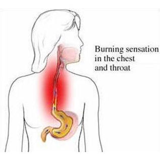 GERD treatment near me