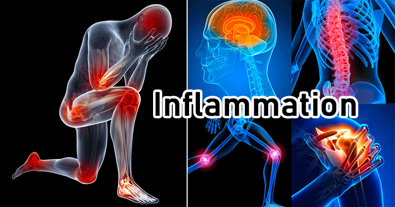 Inflammation.webp