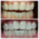 Electrik Image Spa - Teeth Whitening - Monroe - Downriver - Michigan - 7