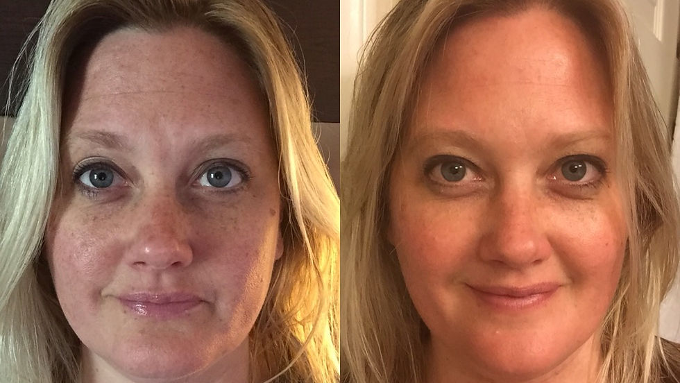 Electrik Image Spa - HydraFacial MD - Monroe - Downriver - Michigan - 11