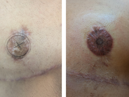 Harry's Journey: From Healing to Confidence