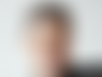 Does Hair Restoration Look Natural?