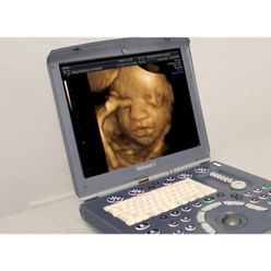 Portable 3D/4D Ultrasound Machines For Sale