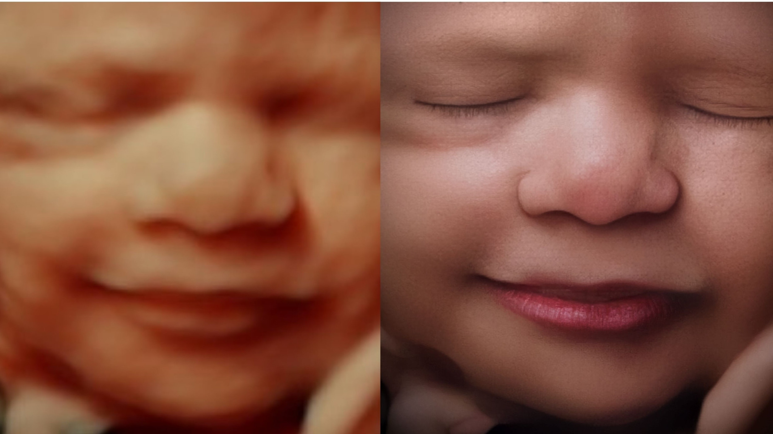Free Gender Reveal Ultrasound Scan 3D Ultrasound And 4D 57 OFF