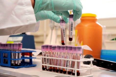 An Athlete's Guide to Receiving a Positive Drug Test in Australia    