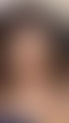 Comment choisir la technique d’extension idéale ?