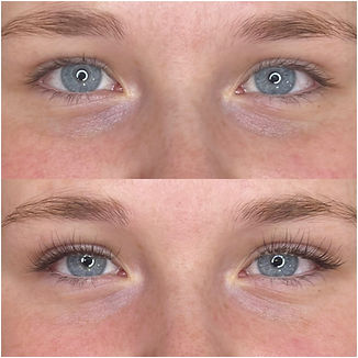 LashDASH Lash services Lash tech LashDASH artist Lash Salon Lash Studio LashDASH Dyersville Dyersville Lashes Iowa LashDASH LashDASH Iowa Dyersville Beauty LashDASH Midwest LashDASH Results Fas tLashes FreshLook LashDASH Before And After LashDASH artist