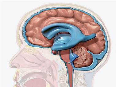 hydrocephalus-nedir_1616102602_edited.jpg
