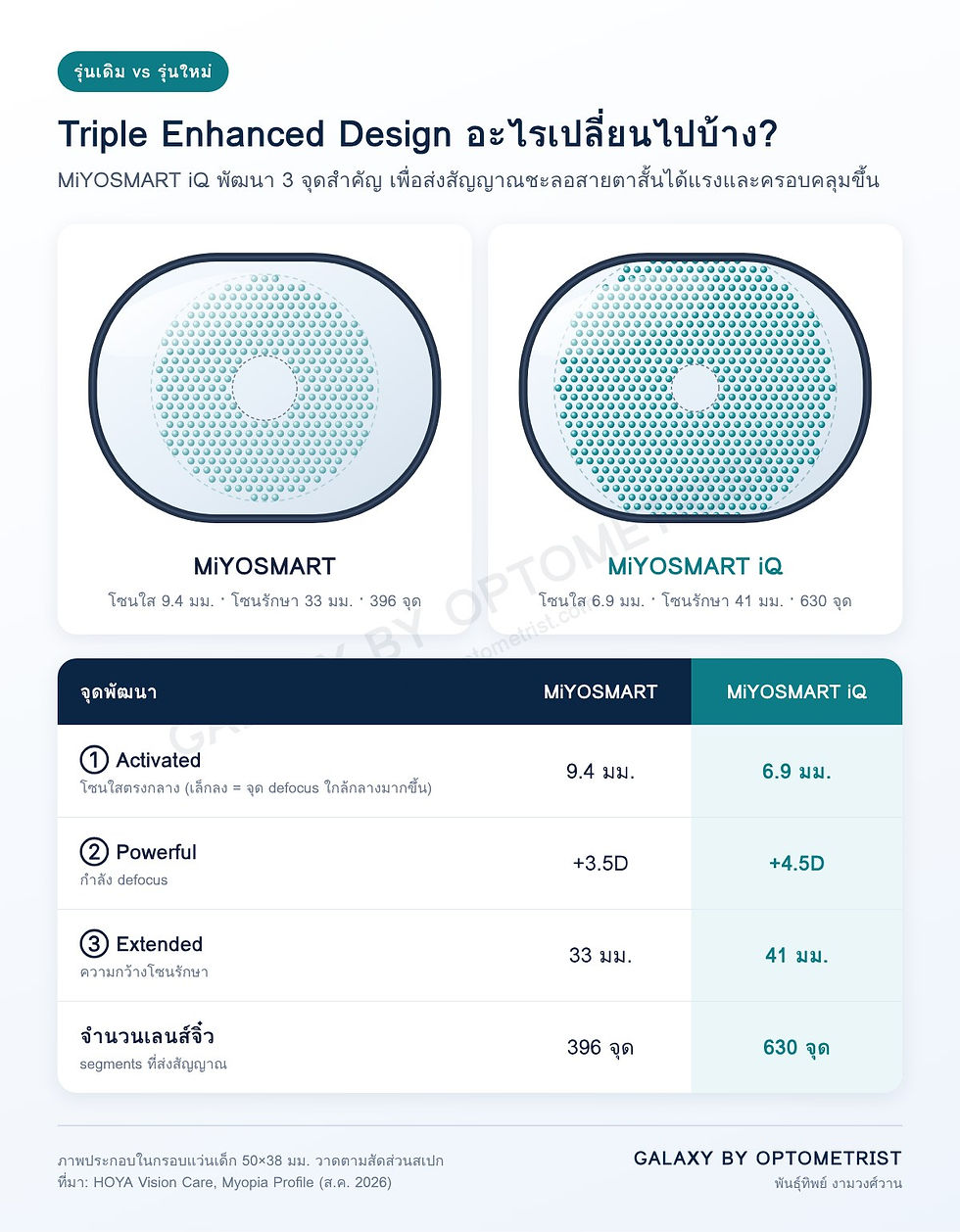 อินโฟกราฟิกเปรียบเทียบ MiYOSMART กับ MiYOSMART iQ: โซนใส 9.4 เป็น 6.9 มม. กำลัง defocus +3.5D เป็น +4.5D โซนรักษา 33 เป็น 41 มม.