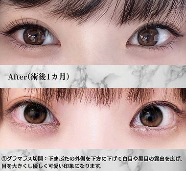 名称未設定のデザイン (14).png