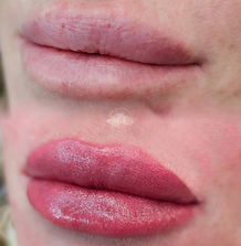 Lip blush restorative work, saying goodbye to a scar in her top lip