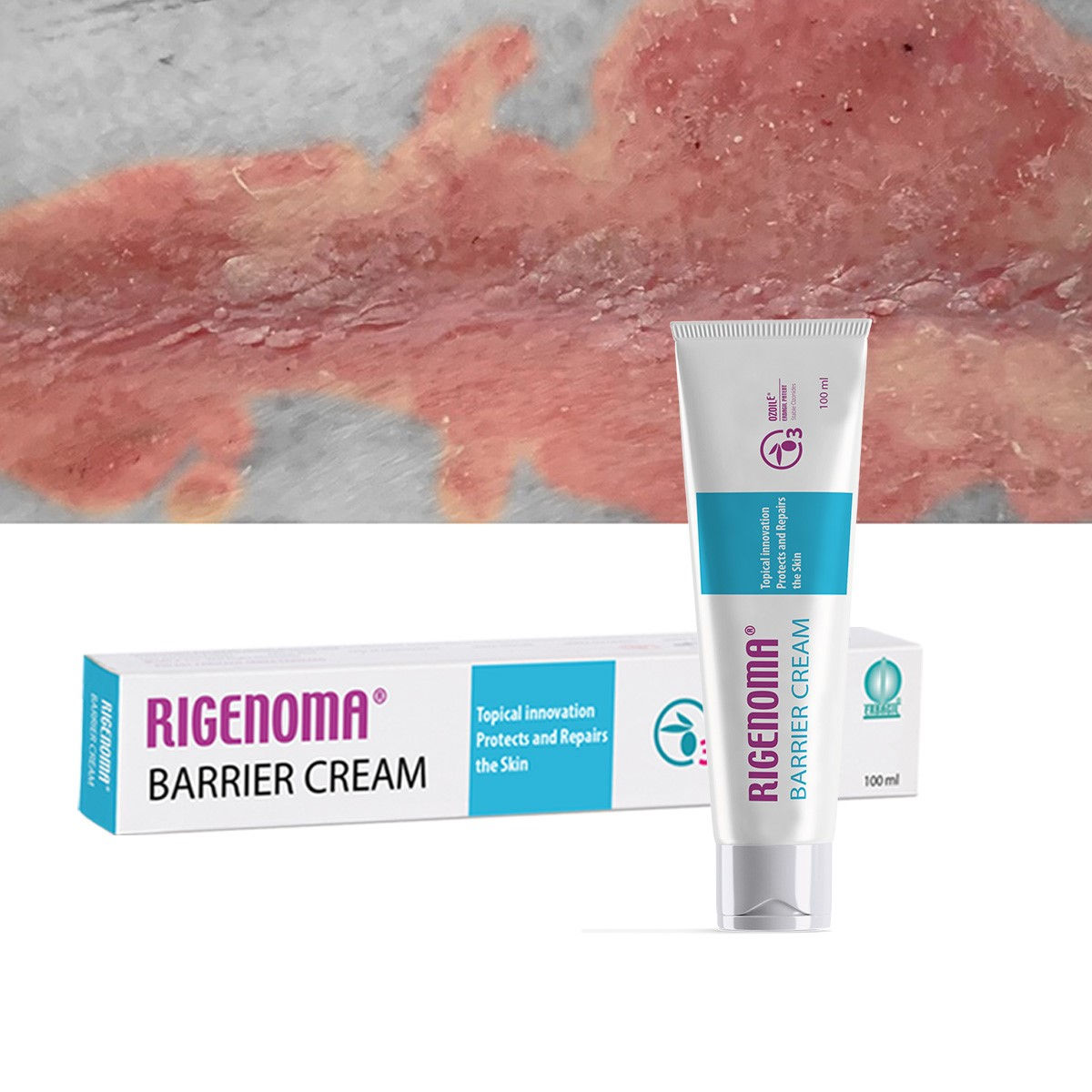 Rigenoma® Barrier Cream, 100ml